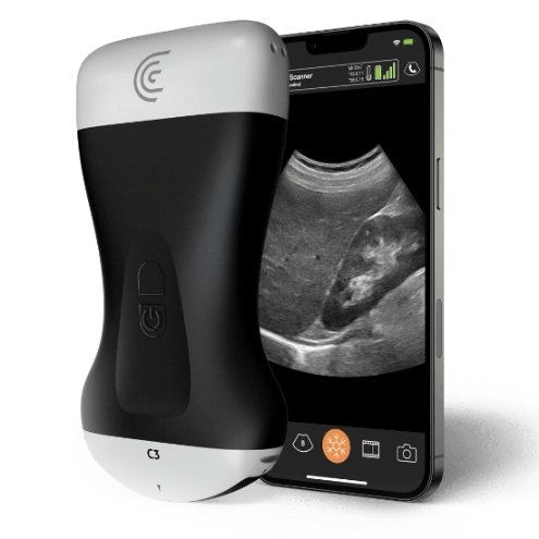 Product-C3-Convex-Handheld-Portable-Wireless-Ultrasound-Scanner